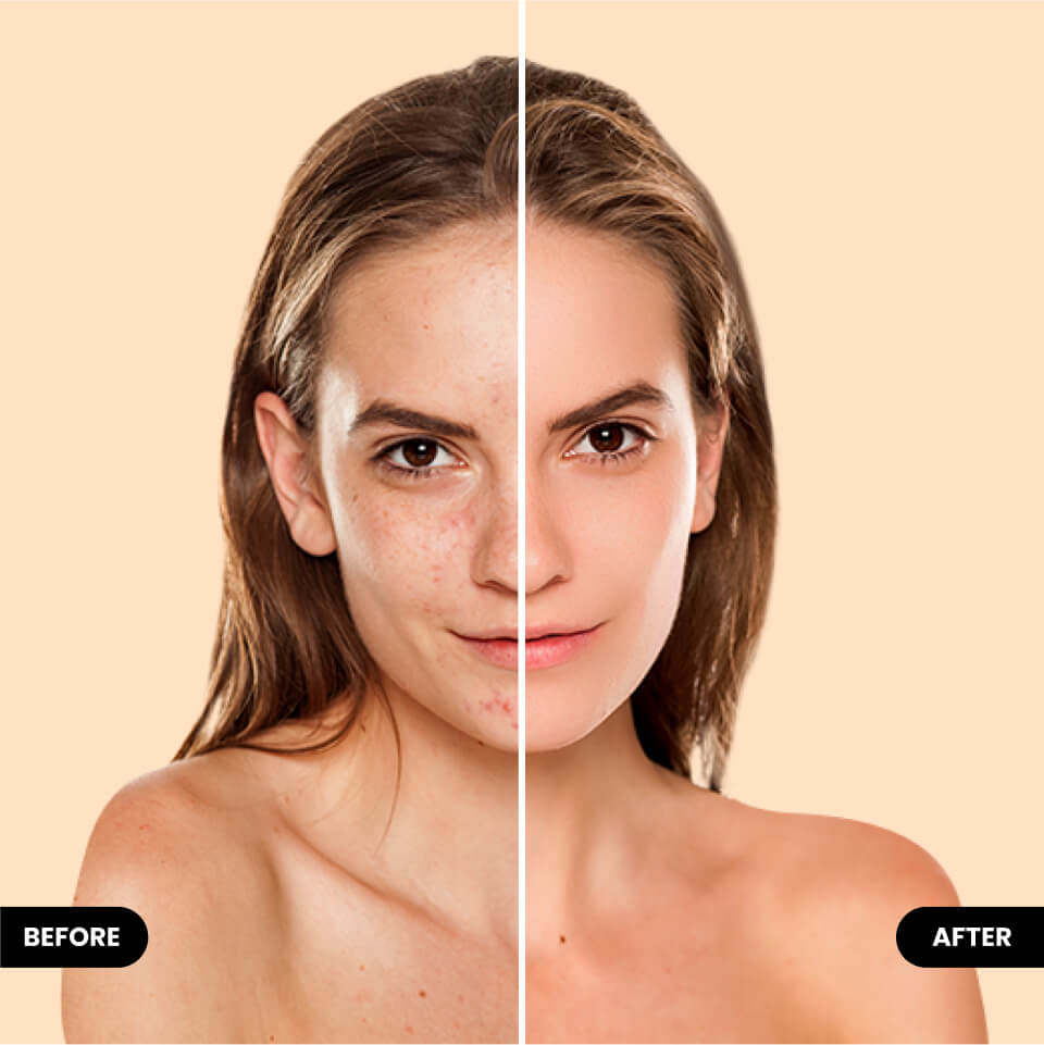 alt.faceEditor.flawlessSkin