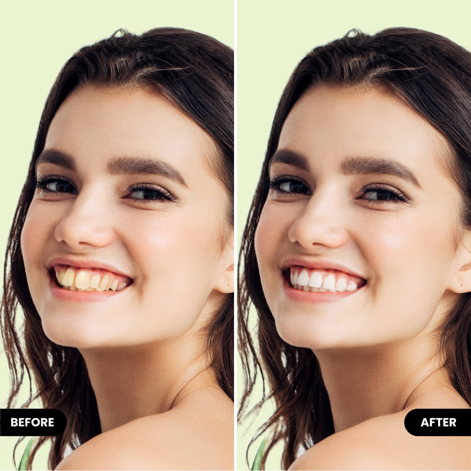 alt.faceEditor.gorgeousSmile