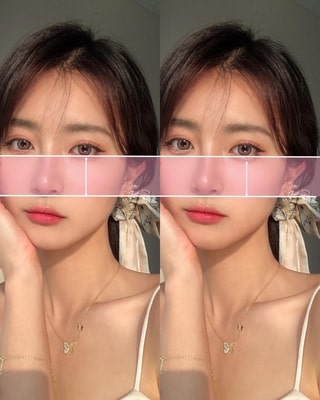 中顔面短縮、Eライン、肩ボト BeautyPlus