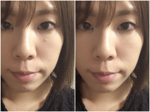 ←Before　After→