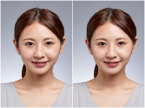 ←Before　After→