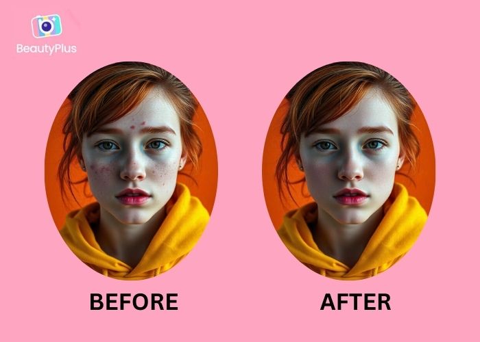 Blemish Removers -beautyplus before and after