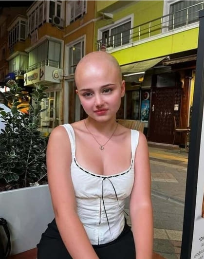 What Would I Look Like Bald-BeautyPlus-after