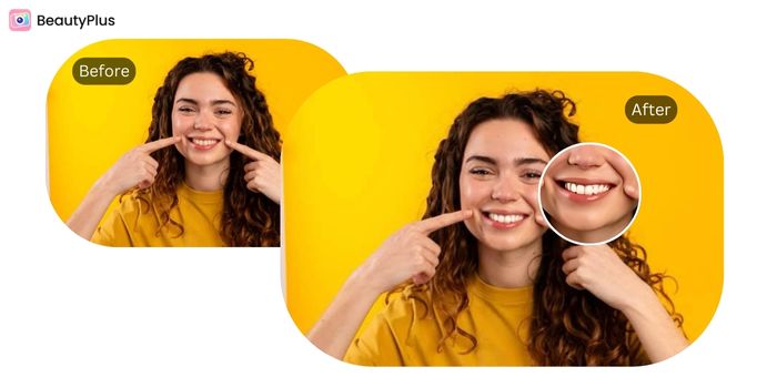 Best Straight Teeth Filter - BeautyPlus App Whiten - Before & After