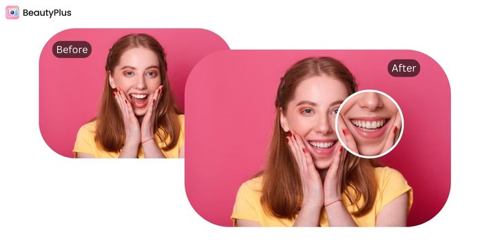 Best Straight Teeth Filter - BeautyPlus Online - Before & After