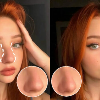 The Best Virtual Nose Job Filter For An Ideal Profile - Cover