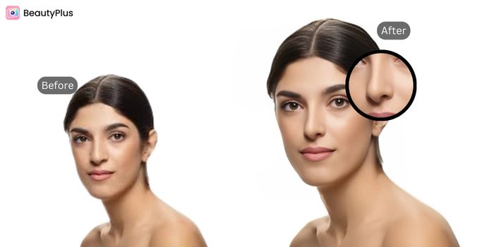The Best Virtual Nose Job Filter For An Ideal Profile - Front Profile - Before & After