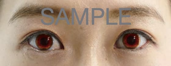 パスポート写真の規定 - 不可 - 赤いコンタクトレンズ
