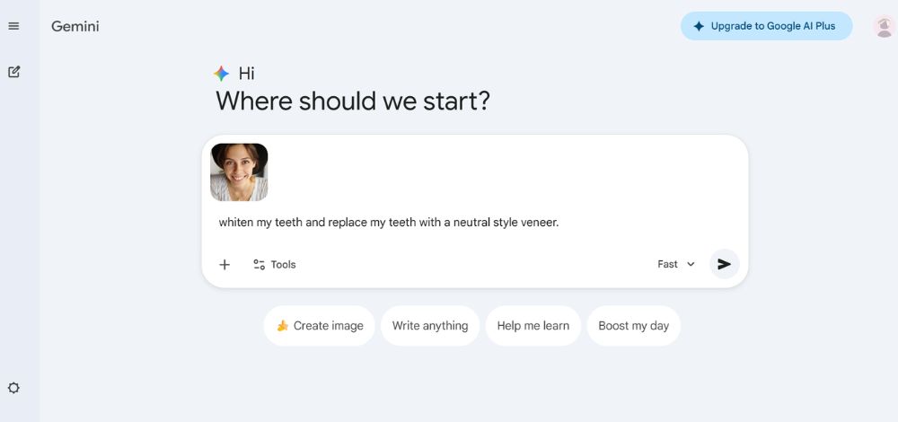 What I would look like with veneers - Gemini - 02