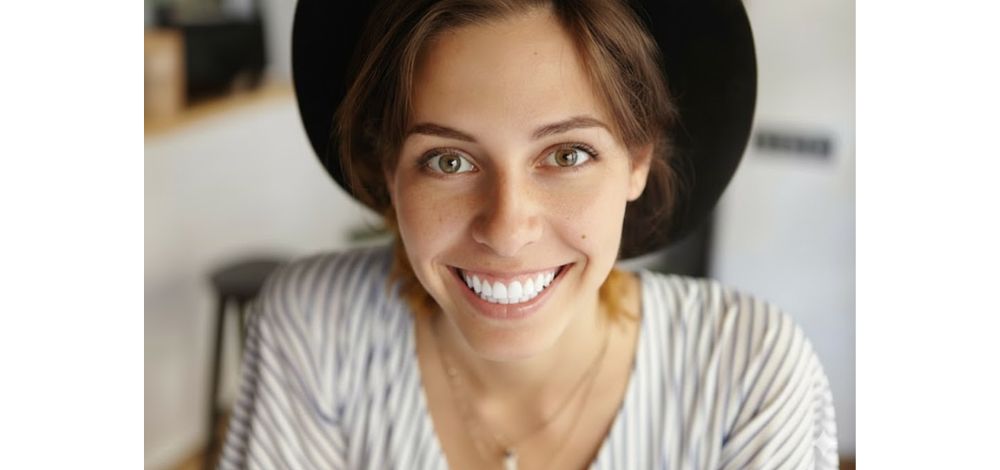 What I would look like with veneers - Gemini - 04