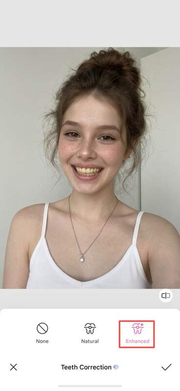 what would i look like with veneers-BeautyPlus app teeth correction and whitening-04