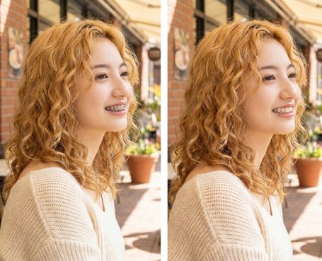 No-Brace-Filter -Beautyplus before after